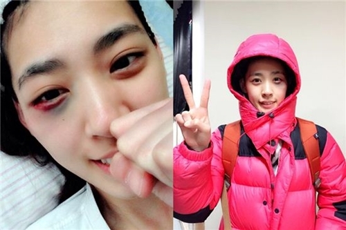 ▲ 로드FC 박지혜 , 로드FC