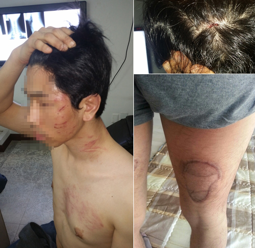 ▲ 사진= 2년 넘게 현대판 노예로 가혹한 폭행은 당한 피해자 J씨. 성남중원경찰서 제공