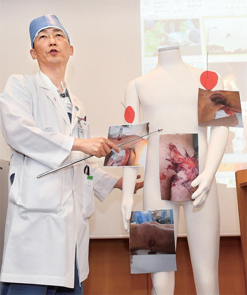 ▲ 15일 오후 수원 아주대병원에서 이국종 교수가 총상을 입은 채 귀순한 북한군 병사의 수술결과 및 환자 상태에 대해 브리핑 하고 있다.  김시범기자
