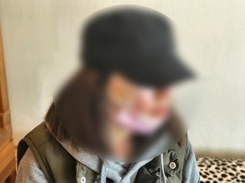 ▲ 다시 만나달라는 옛 애인의 요구를 거절했다가 흉기 보복을 당해 얼굴에 큰 흉터가 남는 등 만신창이가 된 20대 여성의 안쓰러운 사연이 뒤늦게 알려졌다. 피해자 A(20대·여)씨는 지난 2월 18일 오후 9시 55분께 경기도 안산의 한 4차로 도로를 달리던 옛 애인 이모(31)씨의 차량에서 흉기에 얼굴을 찔렸다. A씨는 3개월 전 헤어진 이씨의 다시 만나달라는 요구를 거절했다가 피해를 봤다. 다친 A씨 모습. 경기남부지방경찰청 제공 = 연합뉴스