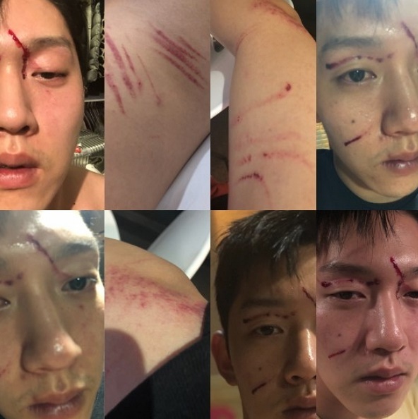 ▲ 구하라에게 폭행을 당했다고 주장하며 최종범씨가 공개한 사건 당시의 사진. 법률사무소 청