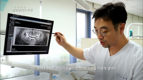 '생로병사의 비밀' 입 속에서 시작된 세균 전쟁, 스스로 병을 키우다. KBS 1TV