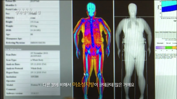 '생로병사의 비밀' 숨어 있는 지방의 경고, 이소성지방. KBS 1TV