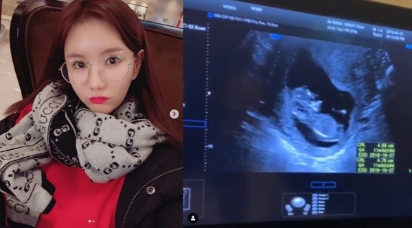 그룹 애프터스쿨 출신 정아가 임신 소식을 전했다. 정아 인스타그램