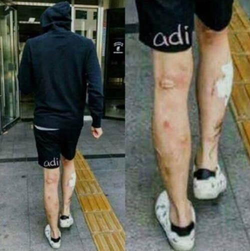 이틀째 논란 중인 박유천의 과거 다리 상처. 온라인 커뮤니티