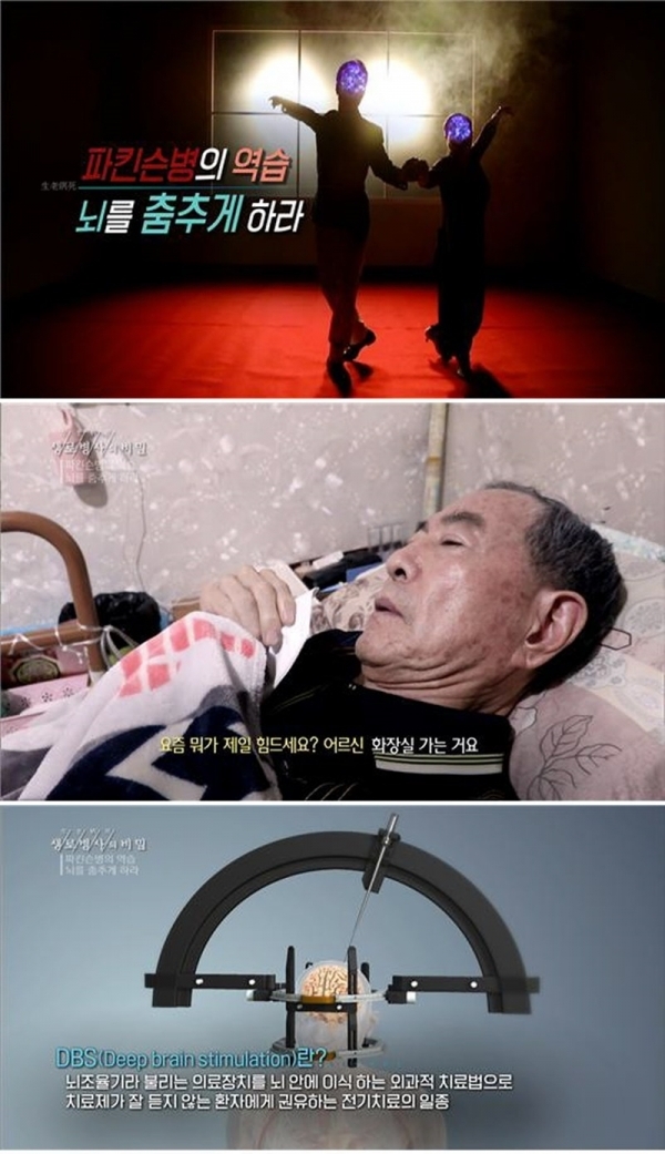 '생로병사의 비밀'에서는 파킨슨병이 무엇인지 그 증상을 알아보고 국내와 해외의 최신 치료법과 대안에 대해 알아본다. KBS 1TV