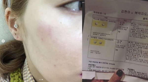 가수 현아가 응급실을 찾았다. 현아 인스타그램