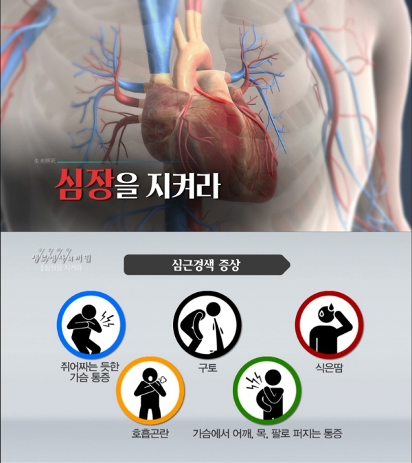 '생로병사의 비밀'에서는  관상동맥질환의 원인과 응급처치, 치료법에 대해 알아본다. KBS 1TV