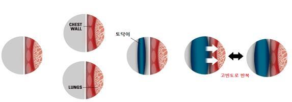 ▲ 토닥이 작동 원리