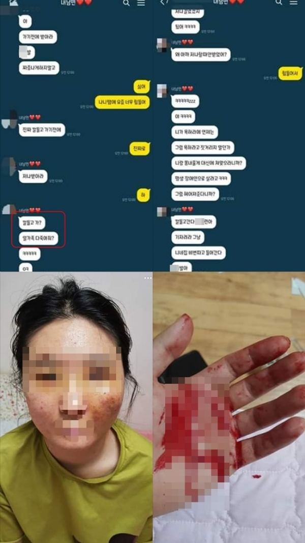 한 누리꾼이 데이트폭력을 당한 동생의 피해 모습과 가해자로부터 받은 협박 메시지를 공개했다. 온라인 커뮤니티