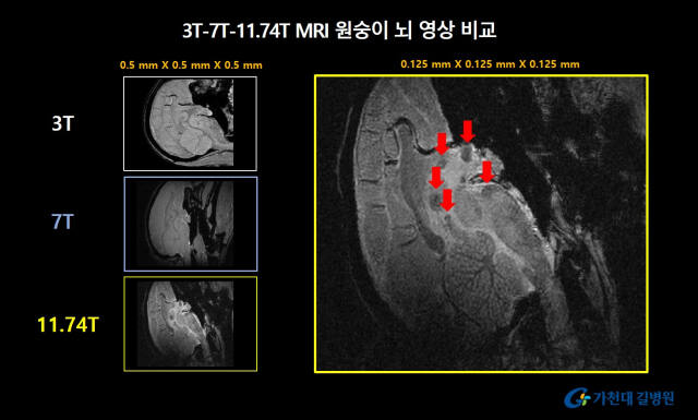 ‘원숭이 뇌 영상 비교’ 11.74T MRI를 이용해 해상도를 0.125mm까지 높인 영상에서는 기존 MRI 영상에서는 확인하기 어렵던 세포핵을 더욱 선명하게 관찰할 수 있다. 가천대 길병원 제공