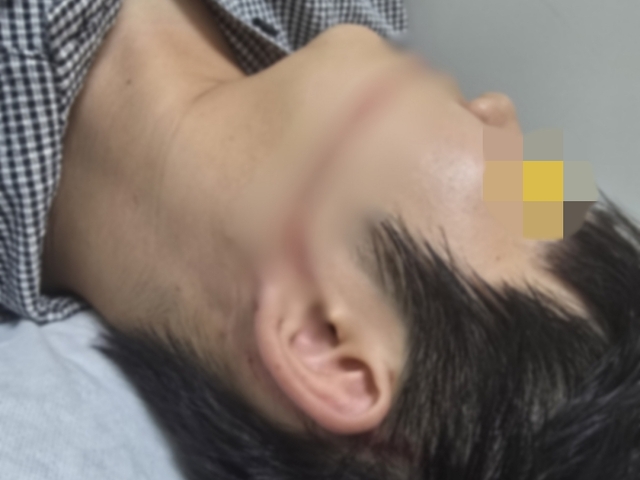 워터건 피습 대학생, 안산시 고소 "봉합수술까지"