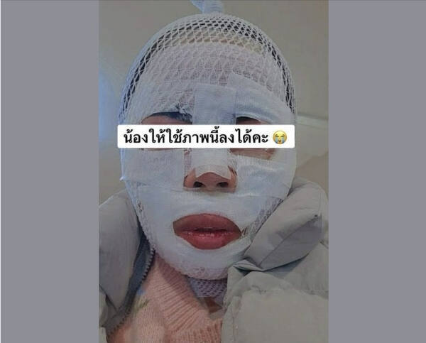 화상 입은 태국인 아내. 페이스북 캡처